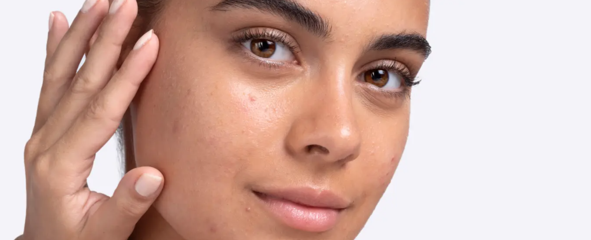 Qu'est-ce qui aide le mieux contre la peau impure ?